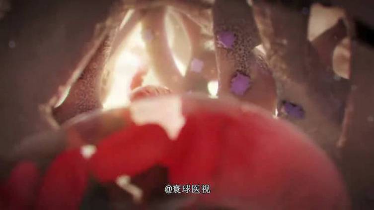 【#运动员跟腱断裂意味着什么#?】跟腱断裂与ACL(前交叉韧带)撕裂,并称“可以毁灭篮球运